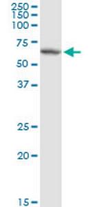 P4HB Antibody in Western Blot (WB)