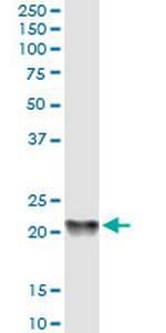 PBP Antibody in Western Blot (WB)