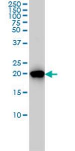 PBP Antibody in Western Blot (WB)