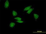 PABPC3 Antibody in Immunocytochemistry (ICC/IF)