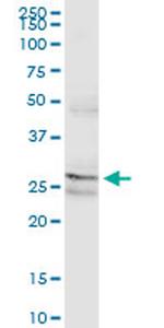 PAFAH1B2 Antibody in Western Blot (WB)