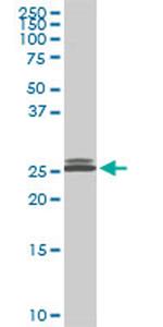 PAFAH1B3 Antibody in Western Blot (WB)