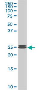 PAFAH1B3 Antibody in Western Blot (WB)