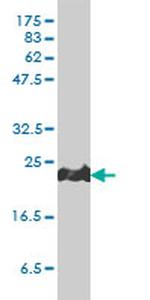 PRDX1 Antibody in Western Blot (WB)