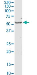SERPINE1 Antibody in Western Blot (WB)