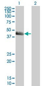 SERPINE1 Antibody in Western Blot (WB)