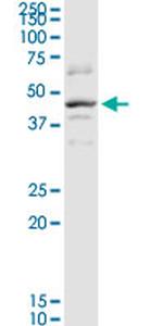 SERPINB2 Antibody in Western Blot (WB)