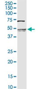 SERPINB2 Antibody in Western Blot (WB)