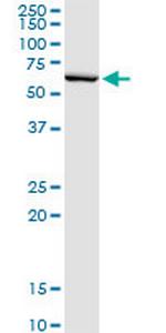 SERPINB2 Antibody in Western Blot (WB)