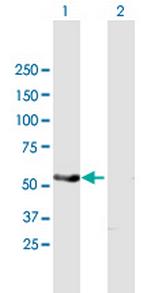 PAK1 Antibody in Western Blot (WB)