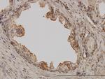 PAK1 Antibody in Immunohistochemistry (Paraffin) (IHC (P))