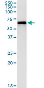 PAK1 Antibody in Immunoprecipitation (IP)