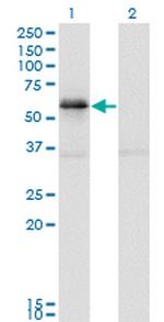 PAK1 Antibody in Western Blot (WB)