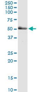 PAK2 Antibody in Western Blot (WB)