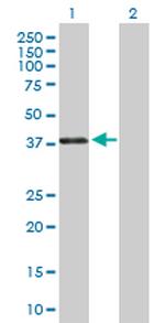 PAX4 Antibody in Western Blot (WB)