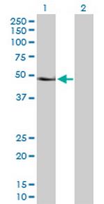 PAX6 Antibody in Western Blot (WB)