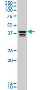 PCBP2 Antibody in Western Blot (WB)