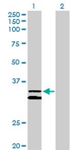 PCDH1 Antibody in Western Blot (WB)