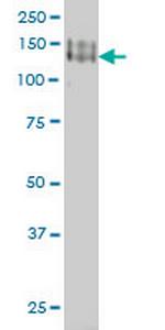 PCDH1 Antibody in Western Blot (WB)