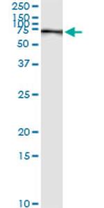 PCK1 Antibody in Immunoprecipitation (IP)