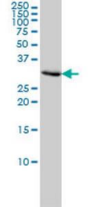 PCNA Antibody in Western Blot (WB)