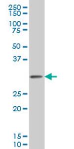 PCNA Antibody in Western Blot (WB)