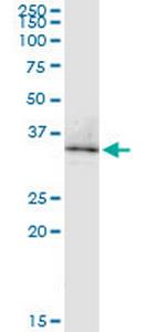 PCNA Antibody in Western Blot (WB)