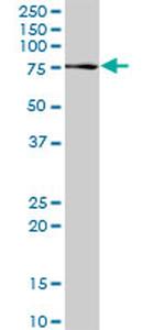 PCSK2 Antibody in Western Blot (WB)