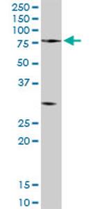 PCSK2 Antibody in Western Blot (WB)