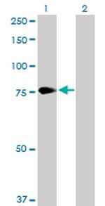 PCSK2 Antibody in Western Blot (WB)