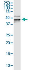 PDCD1 Antibody in Western Blot (WB)