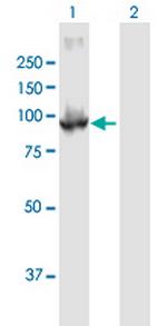 PDE6B Antibody in Western Blot (WB)