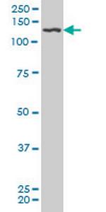 PDGFRB Antibody in Western Blot (WB)