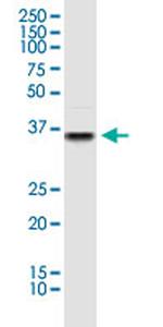 PDHA1 Antibody in Western Blot (WB)