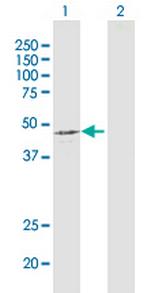 PDHA1 Antibody in Western Blot (WB)