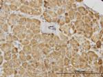 PDK2 Antibody in Immunohistochemistry (Paraffin) (IHC (P))