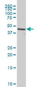 PDK2 Antibody in Western Blot (WB)