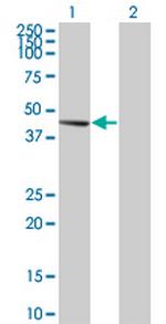 PDK2 Antibody in Western Blot (WB)