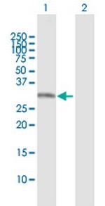 PDYN Antibody in Western Blot (WB)