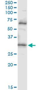 PDYN Antibody in Immunoprecipitation (IP)