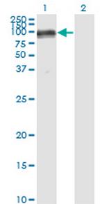 PECAM1 Antibody in Western Blot (WB)