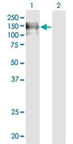 PECAM1 Antibody in Western Blot (WB)