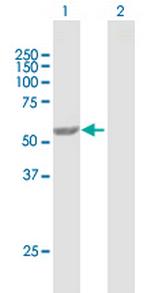 PEPD Antibody in Western Blot (WB)