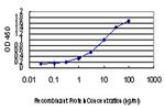 PEPD Antibody in ELISA (ELISA)