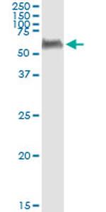 PEPD Antibody in Immunoprecipitation (IP)