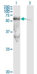 PEPD Antibody in Western Blot (WB)