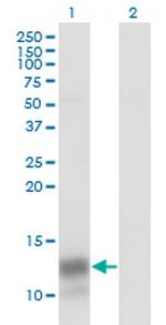 PF4 Antibody in Western Blot (WB)