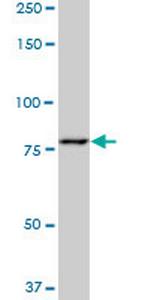 PFKM Antibody in Western Blot (WB)