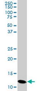 PFN2 Antibody in Western Blot (WB)