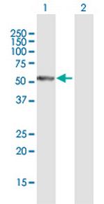 PFTK1 Antibody in Western Blot (WB)